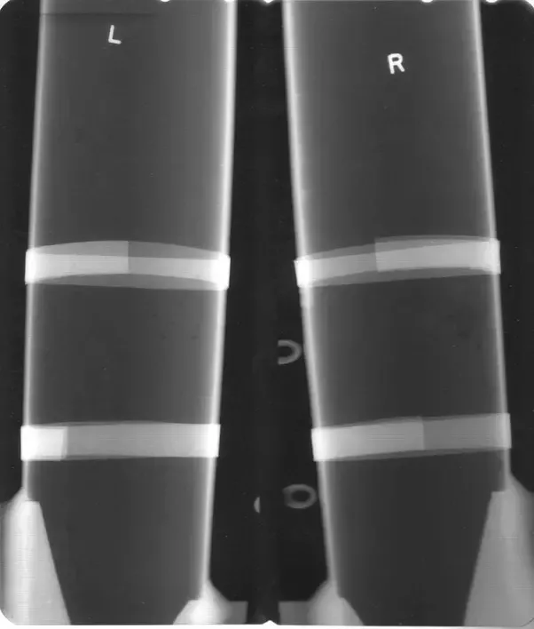 Can airport scanners see through hollow metal tubes Can airport scanners see through hollow metal tubes